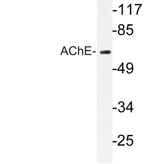 ACHE / Acetylcholinesterase Antibody (Lys585)