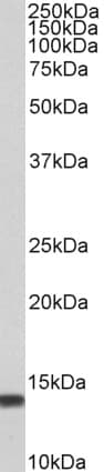 PathPlus™ Polyclonal Goat anti-Human S100A4 / FSP1 Antibody (aa80-C-term, IHC, WB)