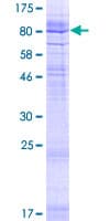 Human GDPD5 Protein (Recombinant GST)