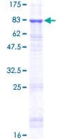 Human TINAG / TIN-AG Protein (Recombinant GST)