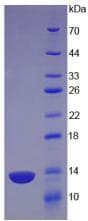 Mouse OSM / Oncostatin M Protein (Recombinant His)