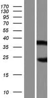 Human AIRE Protein (Over-Expression Lysate Myc-DDK (Flag))