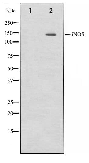 Polyclonal Rabbit anti-Human NOS2 / iNOS Antibody (IHC, IF, WB)