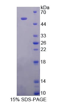 Rat ODC1 / Ornithine Decarboxylase Protein (Recombinant His-T7)