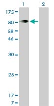 ITGB5 / Integrin Beta 5 Antibody (clone 2C4)