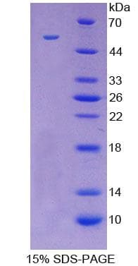 Rabbit LGALS3 / Galectin 3 Protein (Recombinant His-GST)