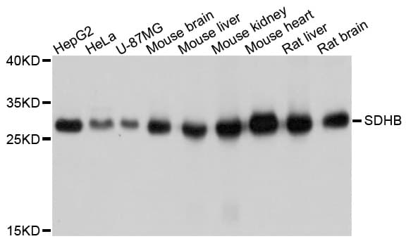 Polyclonal Rabbit anti-Human SDHB Antibody (WB)