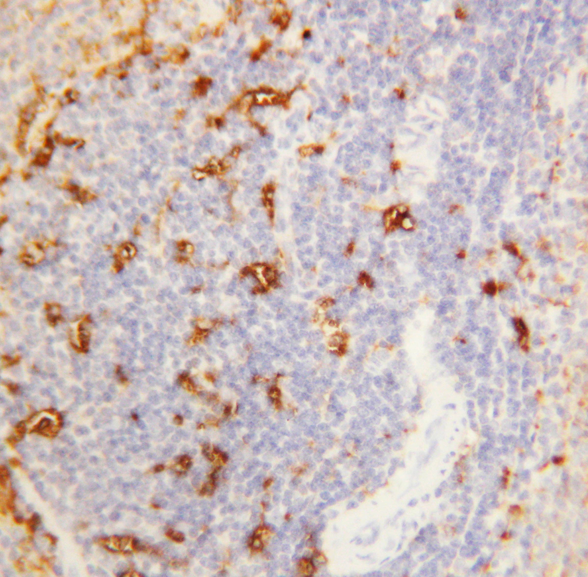 AMY1A / Salivary Amylase Antibody (aa30-44)