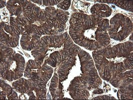 REEP5 Antibody (clone OTI4D2)