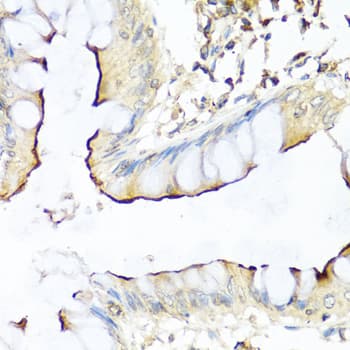 NRG4 Antibody