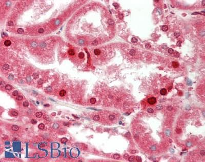 IHC-plus™ Monoclonal Mouse anti-Human WFDC2 / HE4 Antibody (IHC, WB)