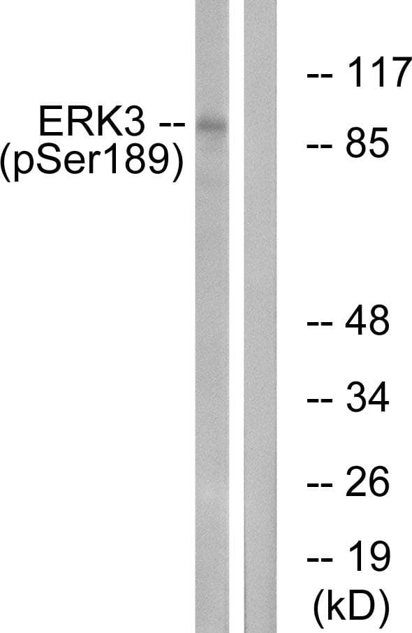 MAPK6 / ERK3 Antibody (phospho-Ser189)