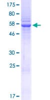 Human SETD3 Protein (Recombinant GST)