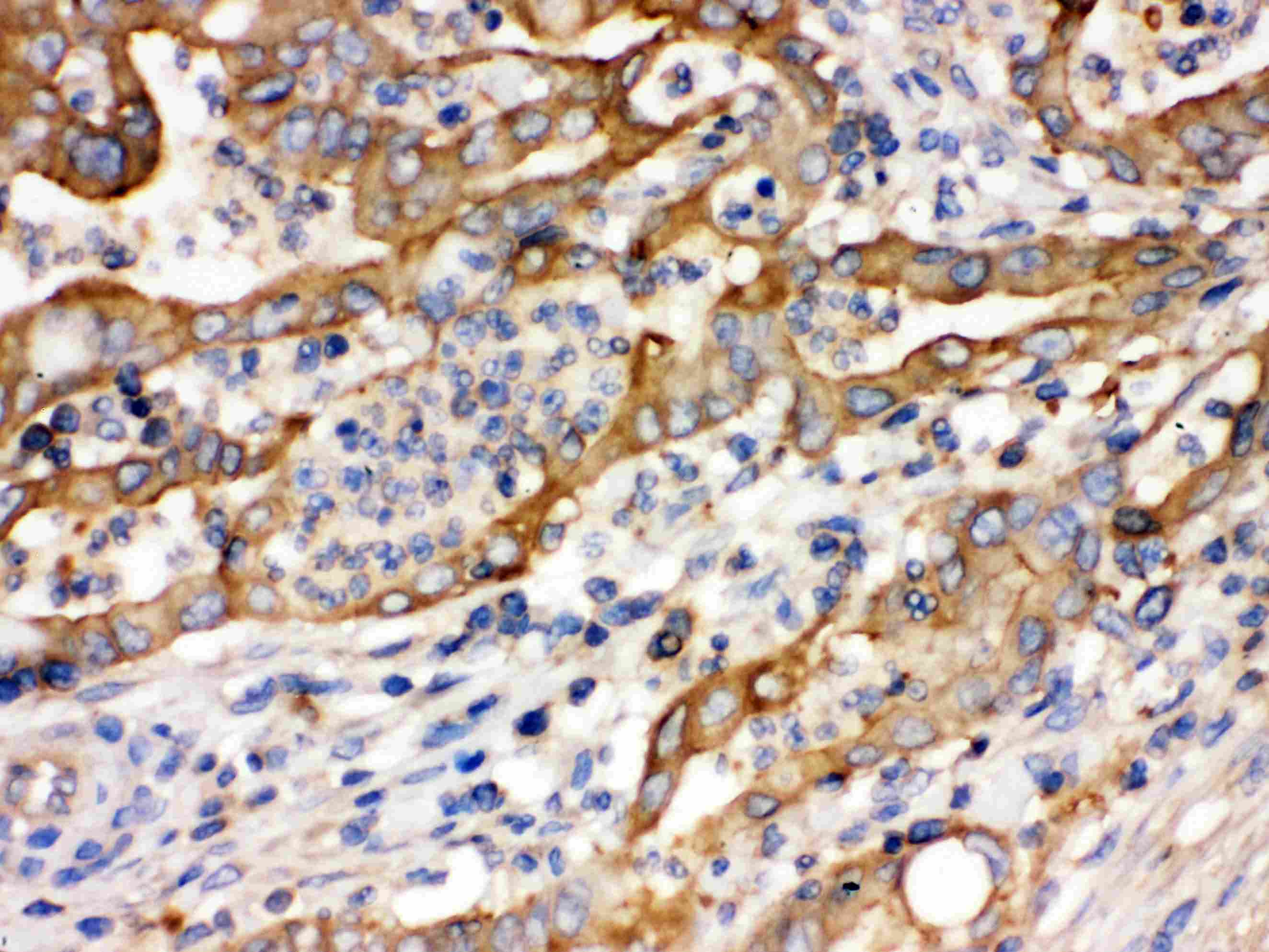 ACTN4 Antibody