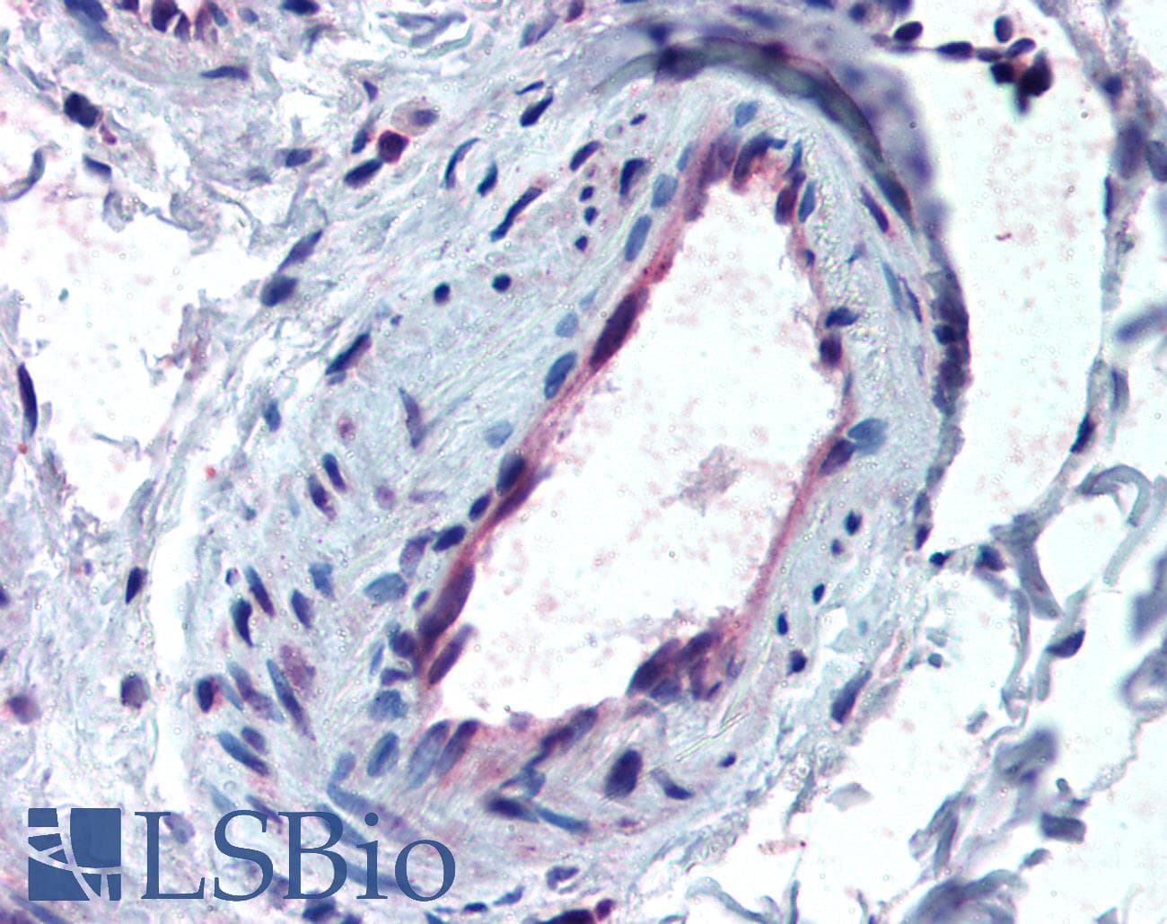 IHC-plus™ ALK2 / ACVR1 Antibody (aa496-509)