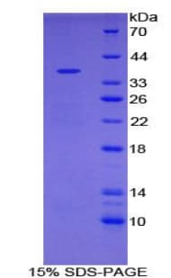 Human UCHL5 / UCH37 Protein (Recombinant His)