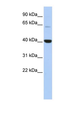 MBD1 Antibody (C-Terminus)