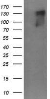 Monoclonal Mouse anti-Human ERBB2 / HER2 Antibody (clone OTI7C2, Carrier-free, aa676-1255, IHC, WB)