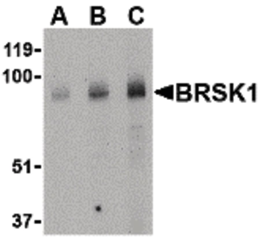 IHC-plus™ KIAA1811 / BRSK1 Antibody