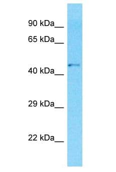 GPR142 Antibody (aa3-52)