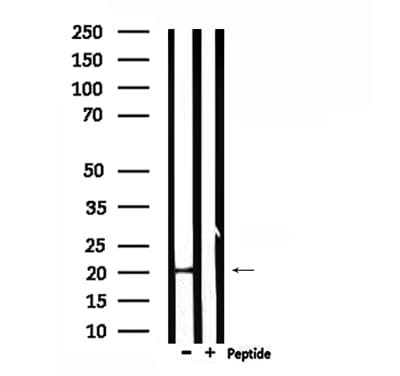 CRH / CRF Antibody