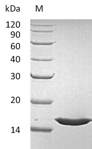 Human FGF1 / Acidic FGF Protein (Recombinant)