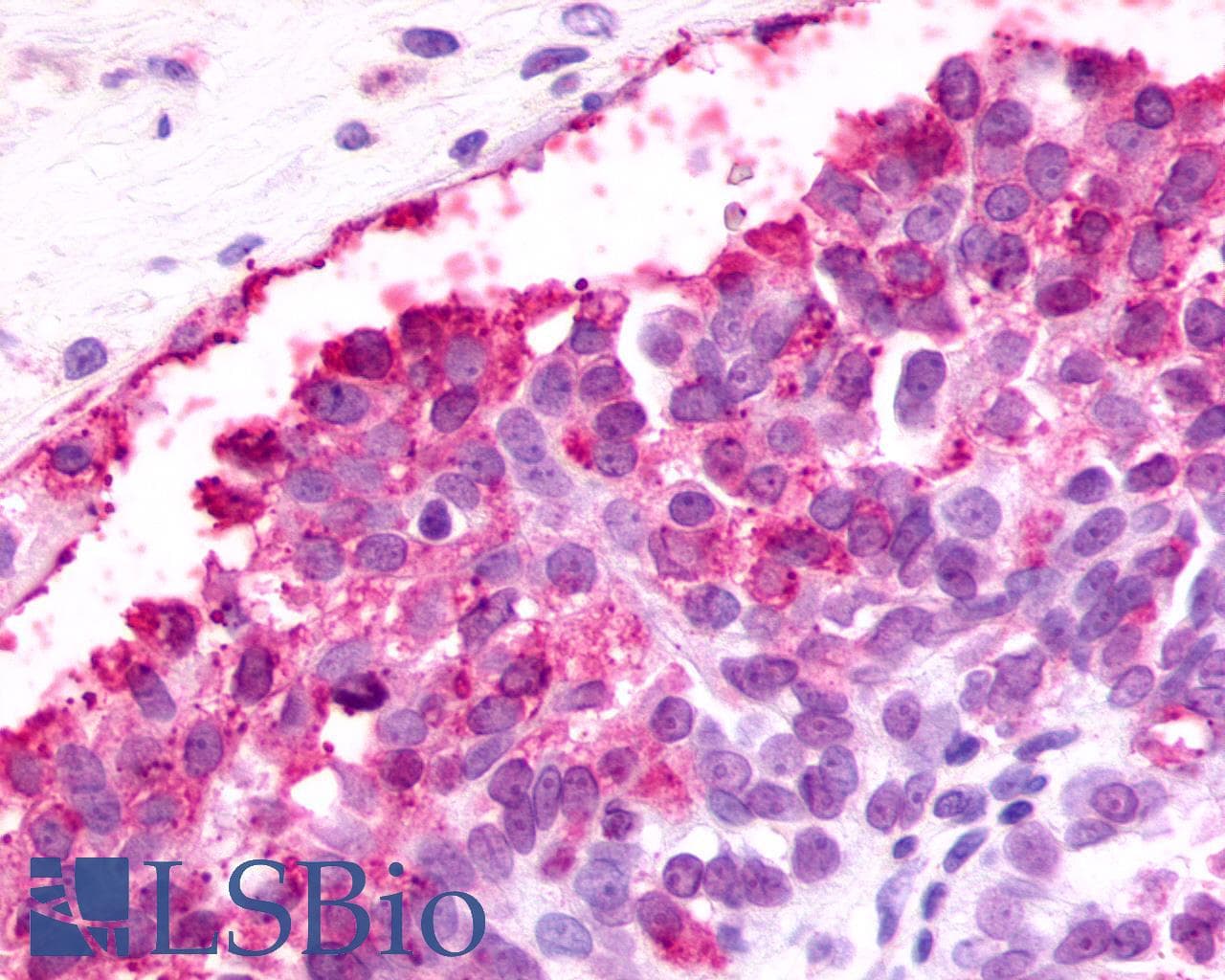 PathPlus™ F2RL3 / PAR4 Antibody (Cytoplasmic Domain)