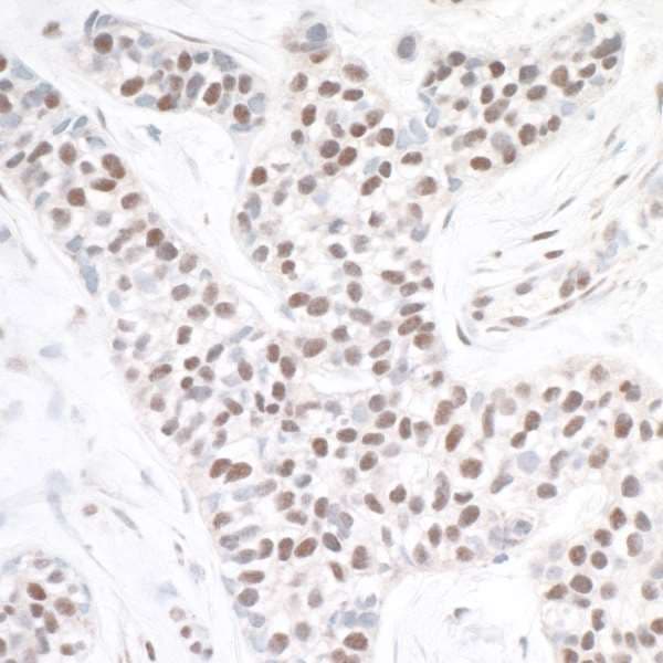 ASH2L / ASH2 Antibody (aa225-275)