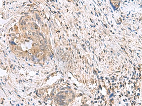 STK32A Antibody