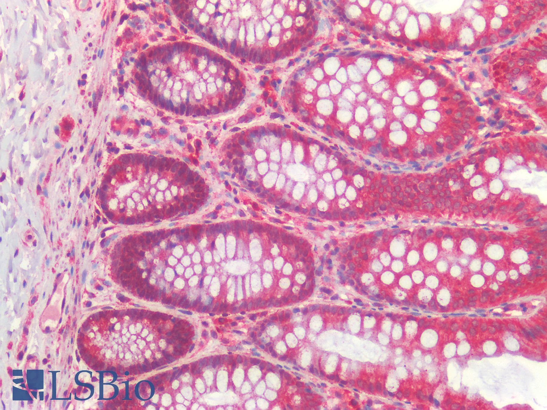 IHC-plus™ HADHA Antibody