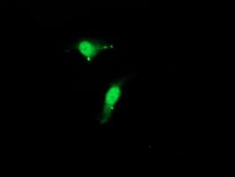 CST3 / Cystatin C Antibody (clone OTI1A6)