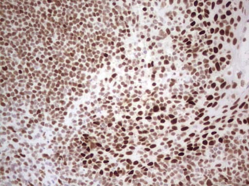 Monoclonal Mouse anti-Human RB1 / Retinoblastoma / RB Antibody (clone OTI3F11, aa309-590, IHC, WB)