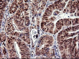 TP73 / p73 Antibody (clone OTI2H2)