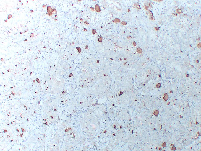 TG / Thyroglobulin Antibody (clone ABT-TG)