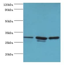 Polyclonal Rabbit anti-Human CAPZB / CAPZ Beta Antibody (aa1-272, IHC, WB)