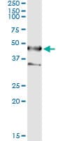 Monoclonal Mouse anti-Human SEPT1 / Septin 1 Antibody (clone 1F12, IF, WB)