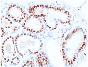ER Alpha / Estrogen Receptor Antibody (clone NR3Ga-2)