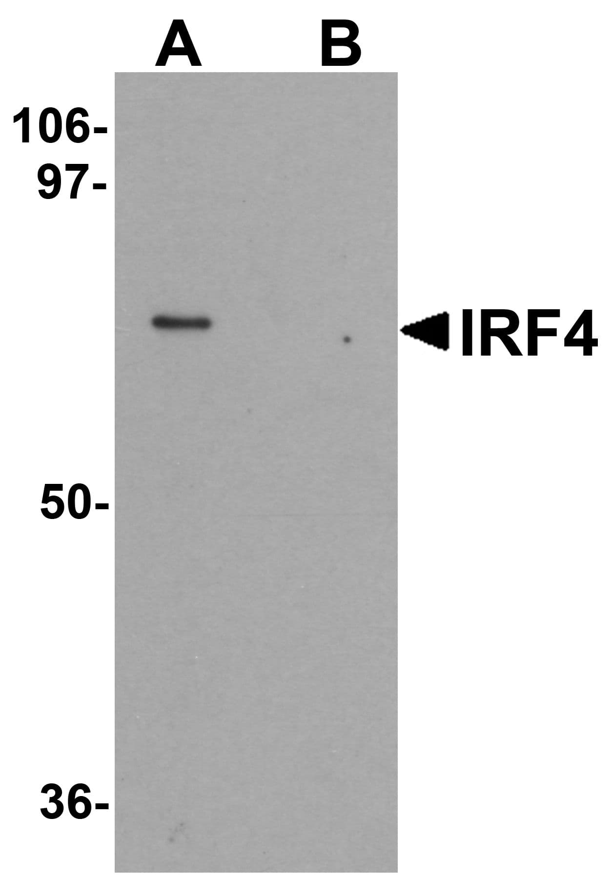 IHC-plus™ Polyclonal Rabbit anti-Human IRF4 Antibody (IHC, IF, WB)