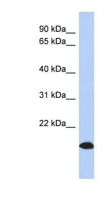Polyclonal Rabbit anti-Human ARL17 A+B Antibody (aa107-156, WB)