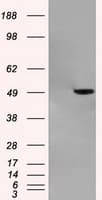 Monoclonal Mouse anti-Human GFAP Antibody (clone OTI5D7, IHC, WB)