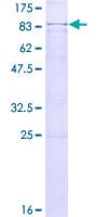 Human HRG Protein (Recombinant GST)
