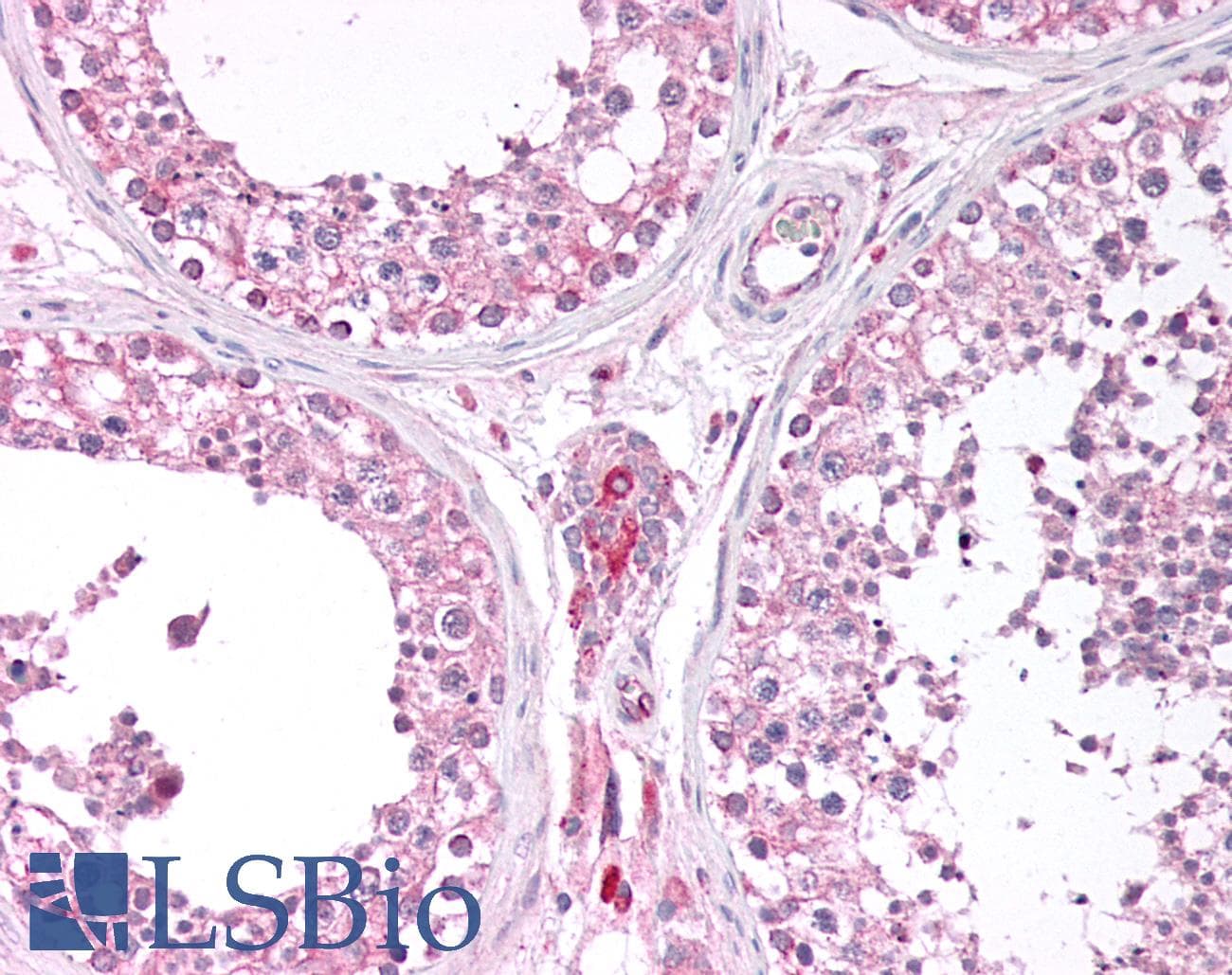 Polyclonal Rabbit anti-Human ESCO1 / ECO1 Antibody (N-Terminus, IHC, WB)