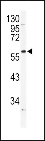 Polyclonal Rabbit anti-Human ADRA1B / Adrenoceptor alpha 1B Antibody (aa270-297, IHC, WB)
