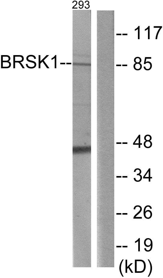 KIAA1811 / BRSK1 Antibody