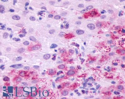 PathPlus™ LHCGR / LHR / LH Receptor Antibody (C-Terminus)