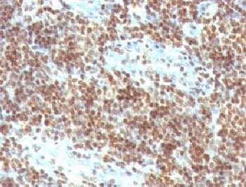 DNA ds Antibody (clone DSD/958)