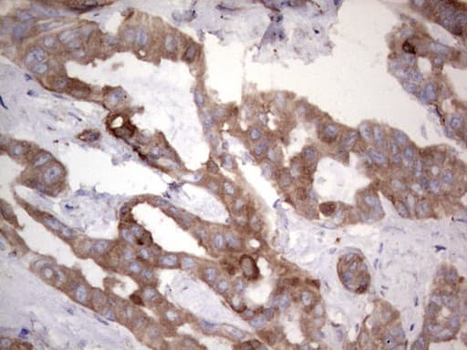 LGALS3 / Galectin 3 Antibody (clone OTI23D12)