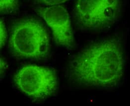Monoclonal Mouse anti-Human CDK5 Antibody (WB)