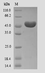Human Ameloblastin / AMBN Protein (Recombinant 6His, N-terminus)