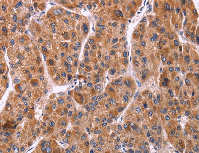 EFNA5 / Ephrin A5 Antibody